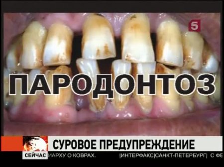 �������� �������� ����� �� ������ �������