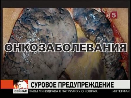 �������� �������� ����� �� ������ �������